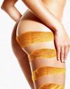 celulitis_piernas1.jpg
