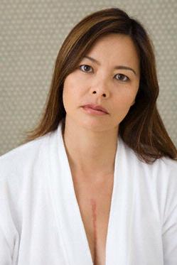 Cicatrices | Patologias Dermatologicas