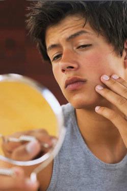 Buenos Consejos para la prevención del acne | Acne