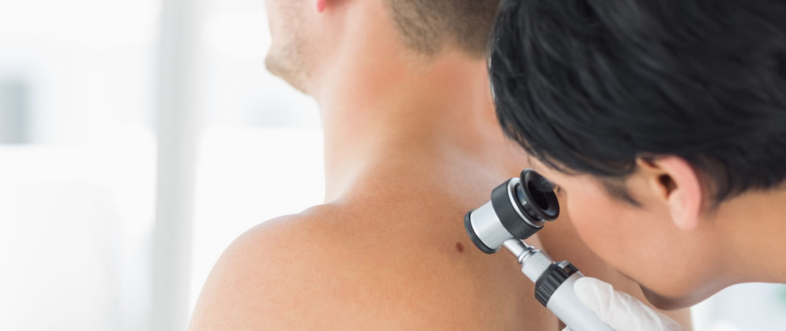 IDERMA Prevent