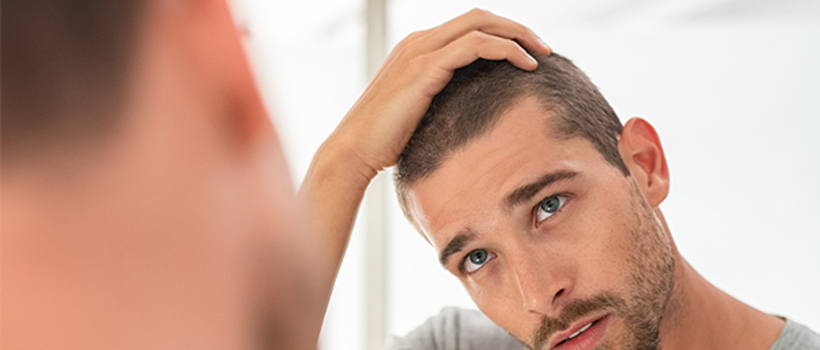 Hair loss in men