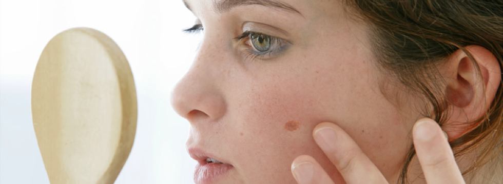 Cómo examinarse la piel