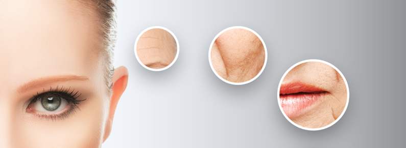 Rejuvenecimiento facial